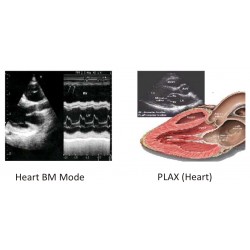 Scientech2364 Working of Medical Ultrasound Machine