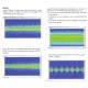 Scientech13E Doppler Sonography