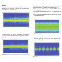 Scientech13E Doppler Sonography