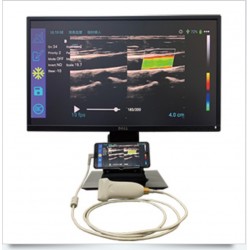 USB-Doppler-Probe Sonda de ultrassom Doppler colorido de alta resolução compatível com Android e Windows