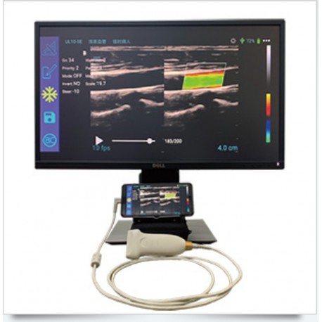 USB-Doppler-Probe High Resolution Color Doppler Ultrasound Probe Compatible with Android and Window System