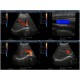 Color doppler ultrasound Body Probe C3 with 3 probe connectors