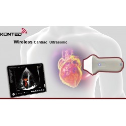 Cardiac Probe AO-C10UC (2.2/3.6Mhz) Wifi/USB connection for iOS, Android & Windows