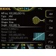 DG1062Z Waveform Generator