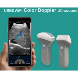 Konted AO-C10UR Color Abdomen Ultrasound USB&Wifi Basic Convex Probe