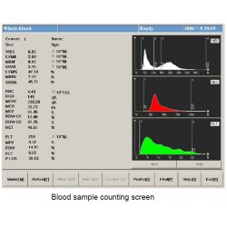 HA-17600 Medical Hematology Analyzer